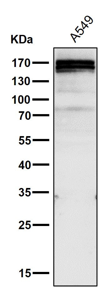 Gli1 (17P5) Rabbit Monoclonal Antibody