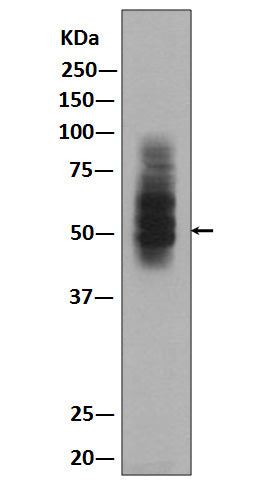 GLUT1 (17B12) Rabbit Monoclonal Antibody