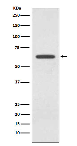 Glutaminase (3F15) Rabbit Monoclonal Antibody