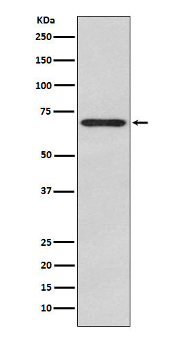 Glypican 3 (18Q6) Rabbit Monoclonal Antibody