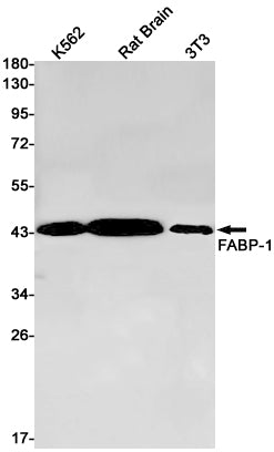 GOT2 (13J19) Rabbit Monoclonal Antibody
