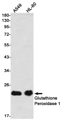 GPX1 (7G14) Rabbit Monoclonal Antibody