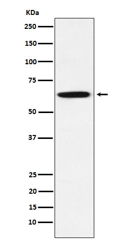 GRB7 (4L2) Rabbit Monoclonal Antibody