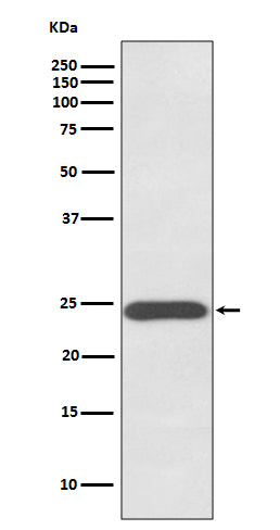 Growth Hormone (12Z11) Rabbit Monoclonal Antibody