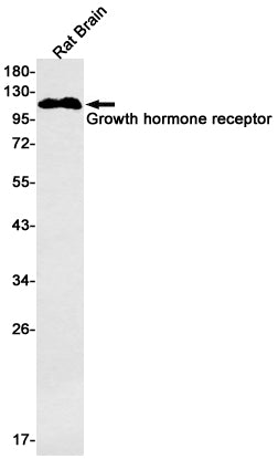 Growth hormone receptor (16L4) Rabbit Monoclonal Antibody