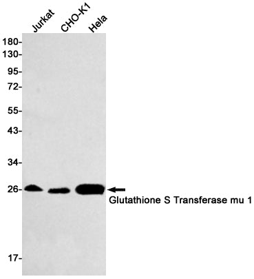 GSTM1 (14O4) Rabbit Monoclonal Antibody