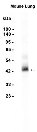 Haptoglobin (11E4) Rabbit Monoclonal Antibody