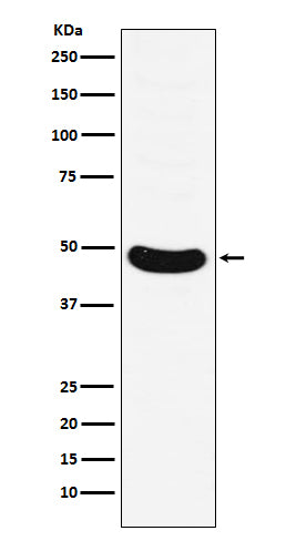 HB9/HLXB9 (17W1) Rabbit Monoclonal Antibody