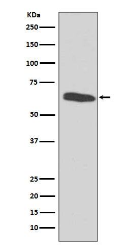 HDAC2 (7L9) Rabbit Monoclonal Antibody