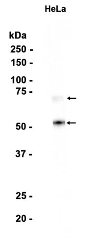 Heparanase 1 (10R18) Rabbit Monoclonal Antibody