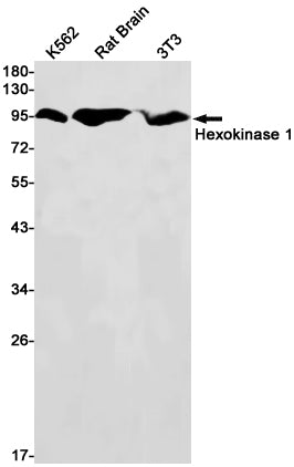 Hexokinase 1 (16D2) Rabbit Monoclonal Antibody