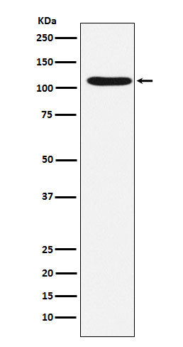 HIRA (17J17) Rabbit Monoclonal Antibody