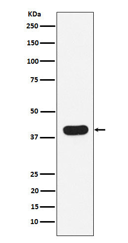 HLA B7 (14R14) Rabbit Monoclonal Antibody