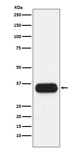 HLA-DQA1 (19V2) Rabbit Monoclonal Antibody