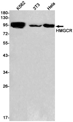 HMGCR (10J19) Rabbit Monoclonal Antibody