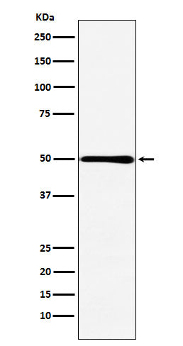 HMGCS2 (13A8) Rabbit Monoclonal Antibody