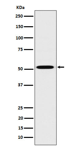 HNF-4-alpha (7C19) Rabbit Monoclonal Antibody