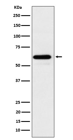 HRPT2 / CDC73 (19W5) Rabbit Monoclonal Antibody