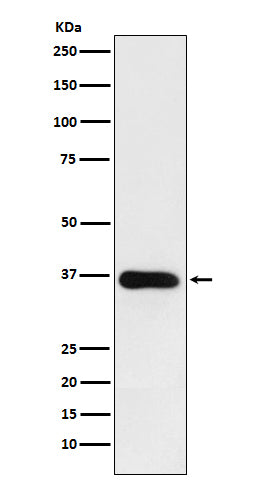 HSD11B1 (17P16) Rabbit Monoclonal Antibody