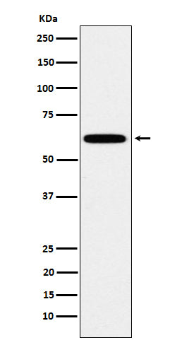 HSF2 (1X11) Rabbit Monoclonal Antibody