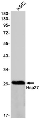Hsp27 (1A15) Rabbit Monoclonal Antibody