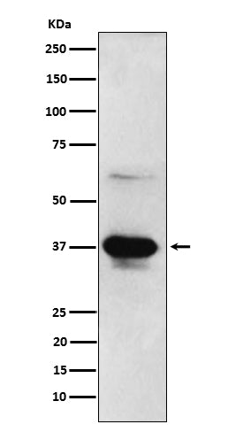 ICAD (16K15) Rabbit Monoclonal Antibody