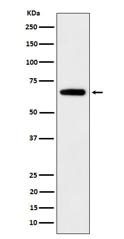 IGF2BP2 (13K3) Rabbit Monoclonal Antibody
