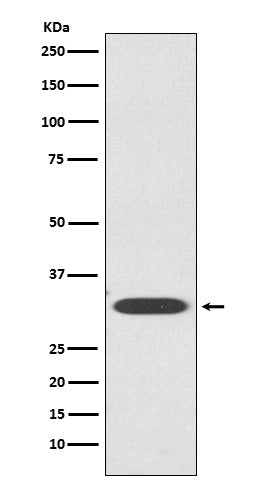 IGFBP1 (14E18) Rabbit Monoclonal Antibody
