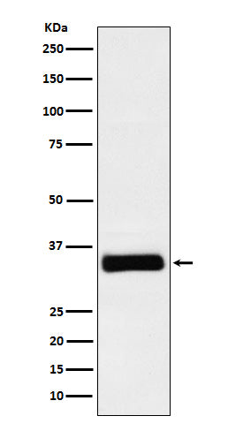 IGFBP2 (12A1) Rabbit Monoclonal Antibody