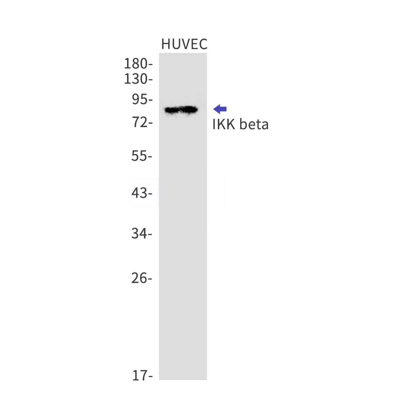 IKK beta (11A19) Rabbit Monoclonal Antibody