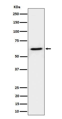 IKZF3 (5L7) Rabbit Monoclonal Antibody