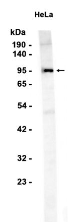 Insulin Receptor (13M3) Rabbit Monoclonal Antibody
