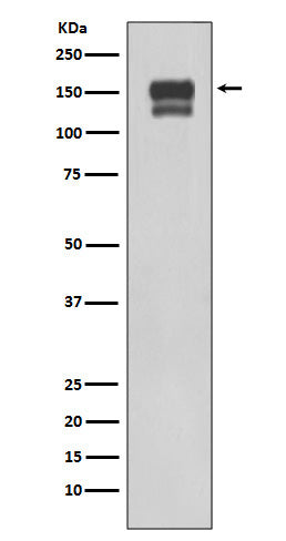 Integrin beta 1 (15X9) Rabbit Monoclonal Antibody