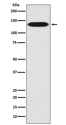 Integrin beta 1 (6K14) Rabbit Monoclonal Antibody