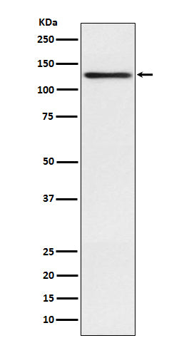 Involucrin (10K9) Rabbit Monoclonal Antibody