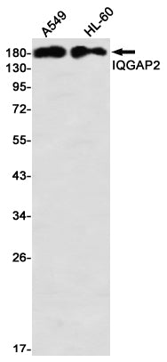 IQGAP2 (18D18) Rabbit Monoclonal Antibody