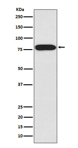 IRAK (15J6) Rabbit Monoclonal Antibody