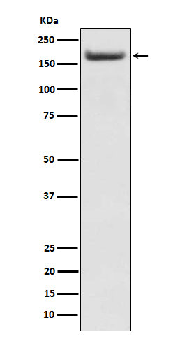 IRS2 (17U8) Rabbit Monoclonal Antibody