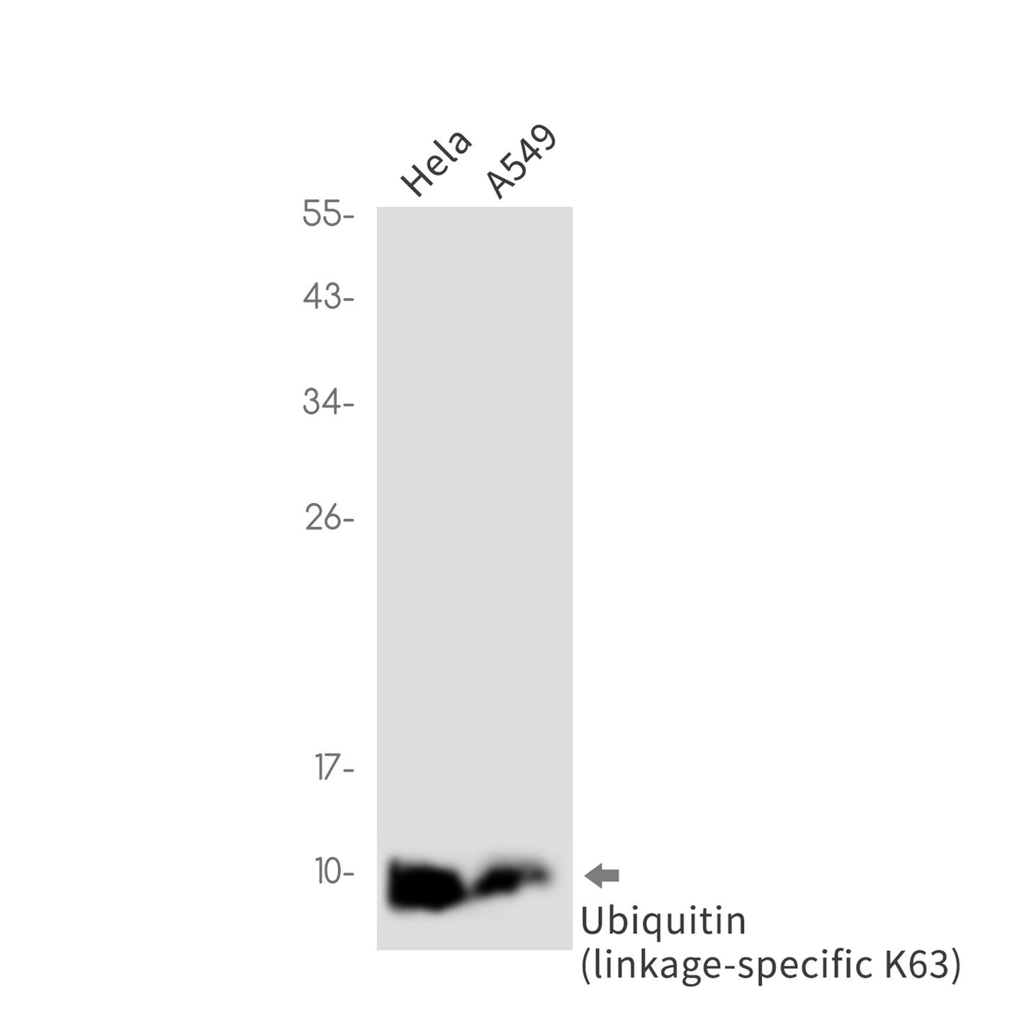 K63-linkage Specific Ubiquitin (4W15) Rabbit Monoclonal Antibody