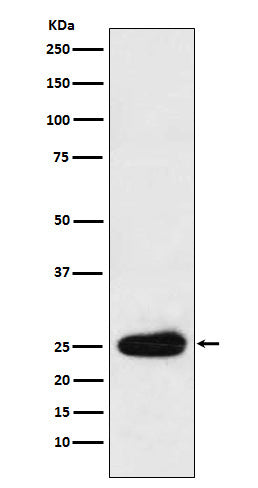 Kappa light chain (6H2) Rabbit Monoclonal Antibody
