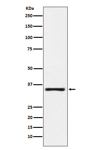 KLK2 (11A15) Rabbit Monoclonal Antibody