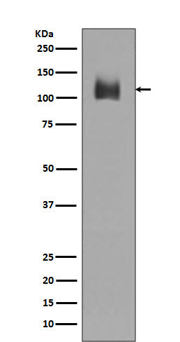 LAMP2 (4P12) Rabbit Monoclonal Antibody