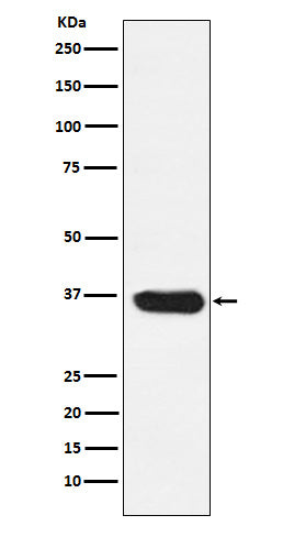 LDHA (4H19) Rabbit Monoclonal Antibody
