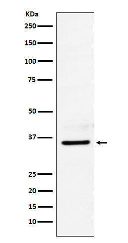 LDHB (13O6) Rabbit Monoclonal Antibody