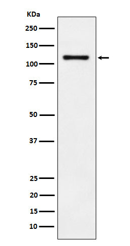 LI Cadherin (14P12) Rabbit Monoclonal Antibody