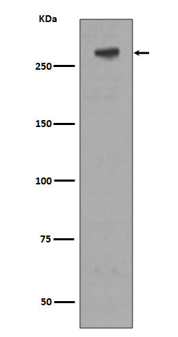 M6PR/IGF2R (11G10) Rabbit Monoclonal Antibody