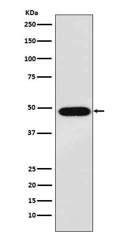 MAGE 1 (12F10) Rabbit Monoclonal Antibody