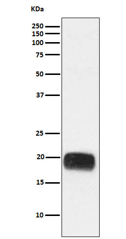 Mammaglobin A (8R14) Rabbit Monoclonal Antibody