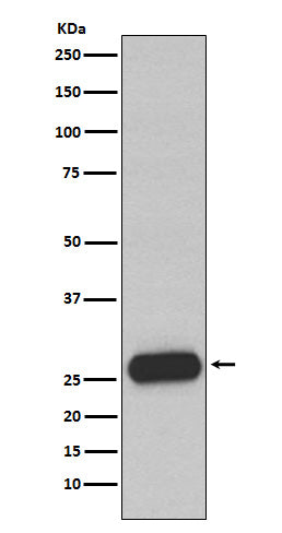 Mast Cell Chymase (13J16) Rabbit Monoclonal Antibody