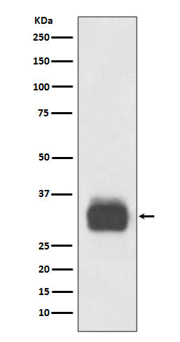 Mast Cell Tryptase (7Q2) Rabbit Monoclonal Antibody